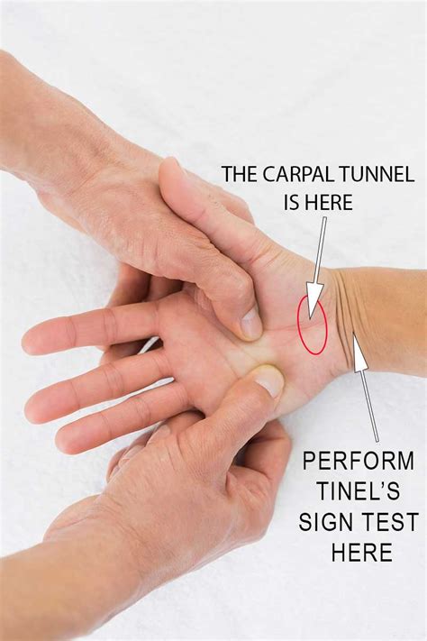 median nerve compression test carpal tunnel|positive test for carpal tunnel.